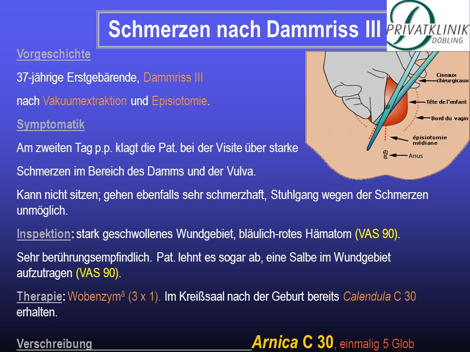 Die Hämorrhoide die Behandlung von den Volksmitteln